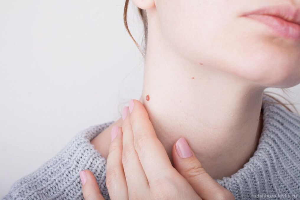 Patogeneza HPV