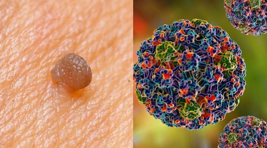 Poti prenosa HPV